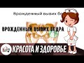 Врожденный вывих бедра