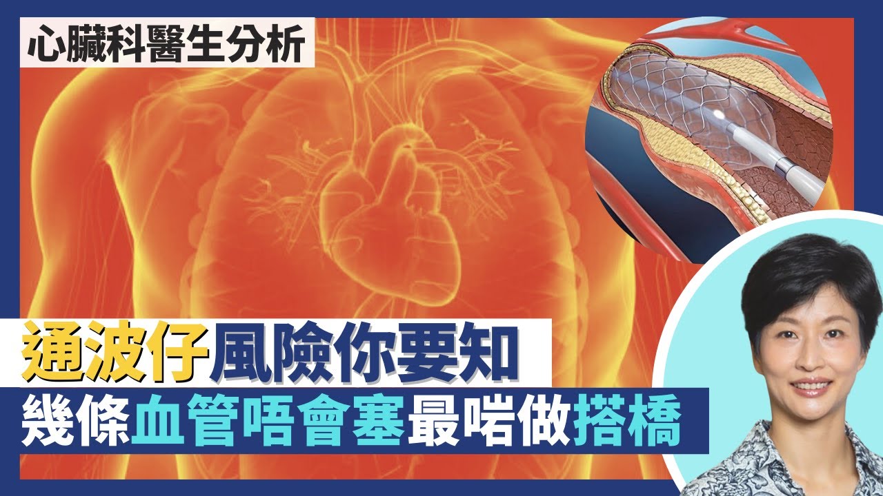心臟病通波仔風險全分析！唔通波仔做搭橋手術 幾條血管永不血栓最啱搭橋？通波仔微創手術傷口得2mm 支架幼過頭髮？｜王建芳醫生 心臟科醫生吳基恩醫生｜人類健康研究所