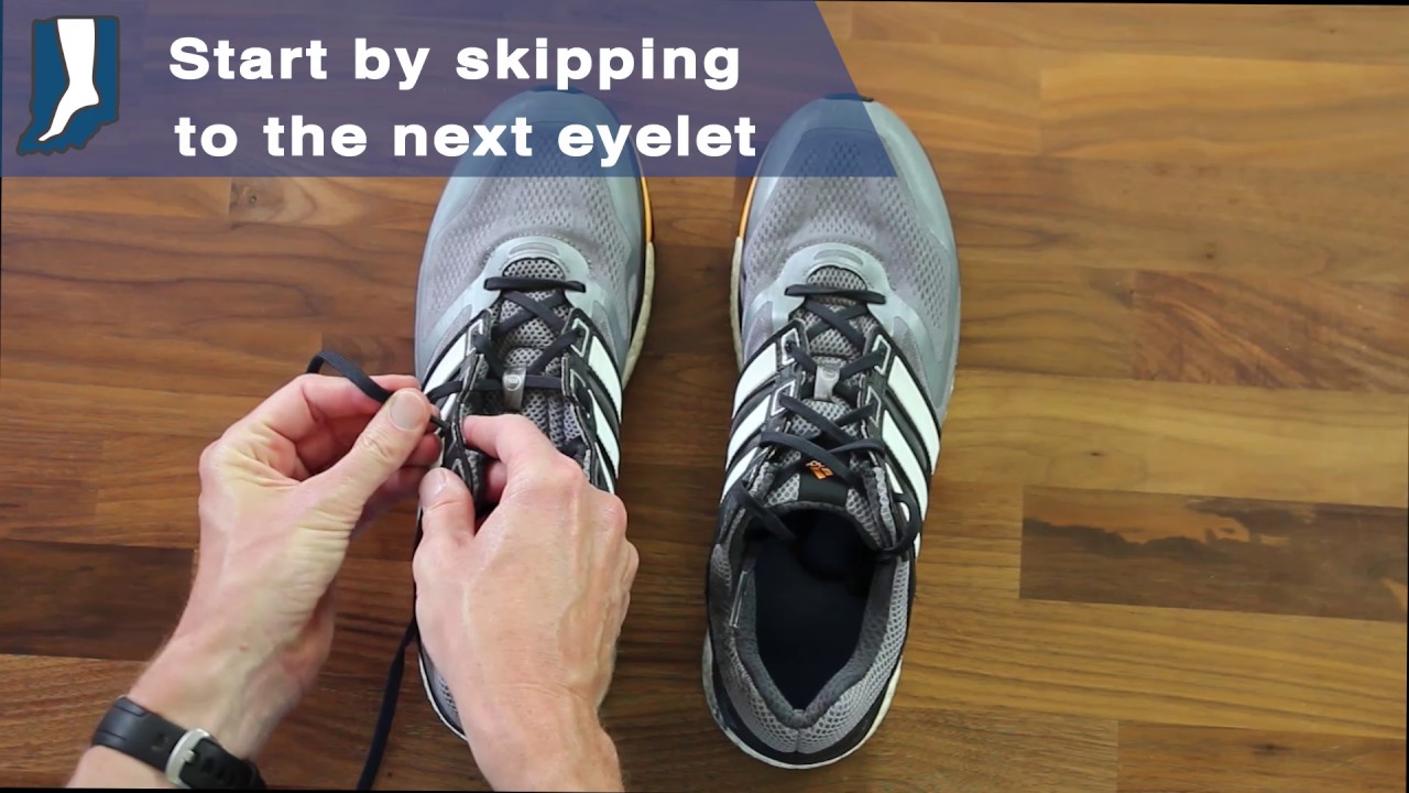 How to Lace Running Shoes to Prevent 