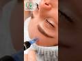 "মাইক্রোনিডলিং কোলাজেন উৎপাদন বাড়িয়ে ওপেন পোরস ছোট করে, ত্বককে টাইট ও ন্যাচারালি গ্লোয়িং করে"
