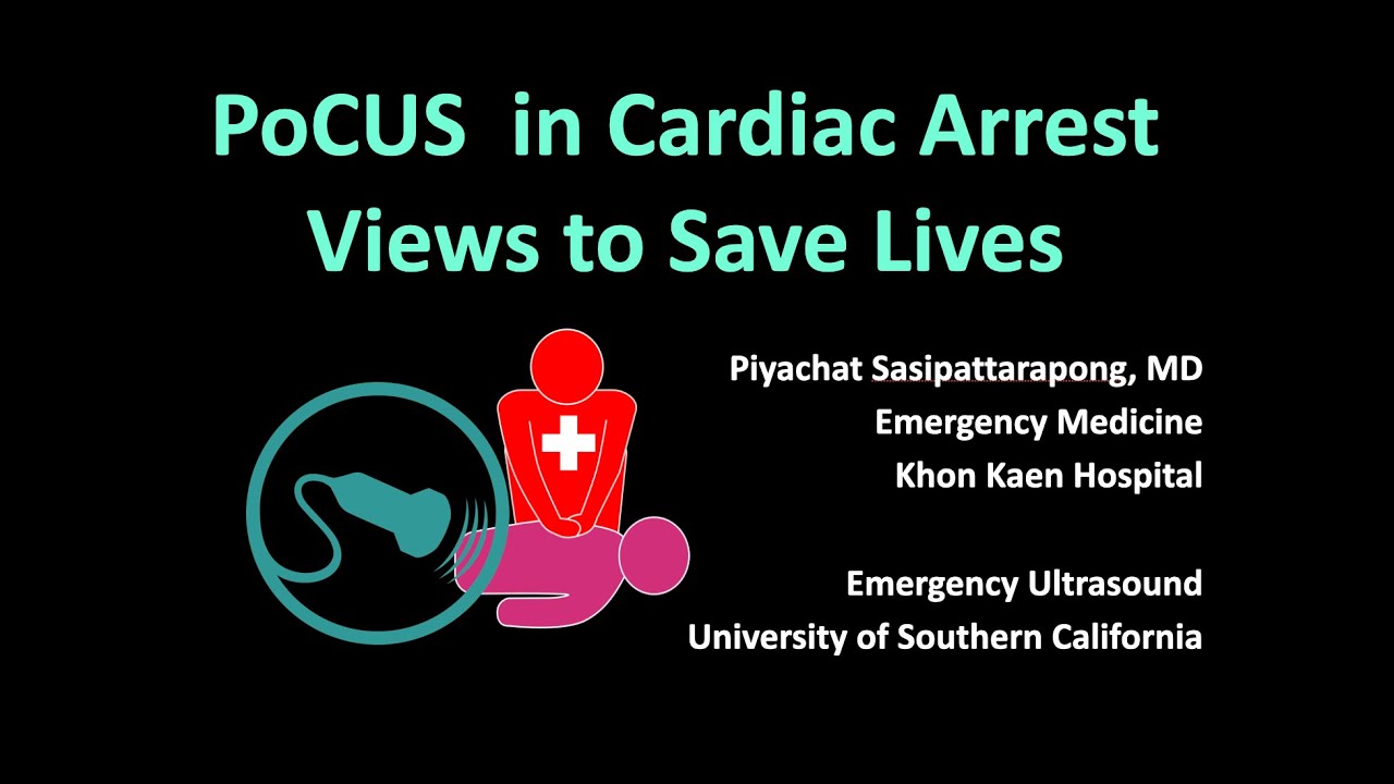 POCUS in Cardiac Arrest