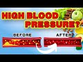Top 10 Foods to Naturally Lower Blood Pressure & what to Stop Eating from Today!