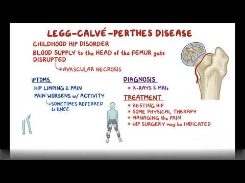 Legg Calve Perthes Disease- Causes, Symptoms, Diagnosis & Treatment (Pathology)