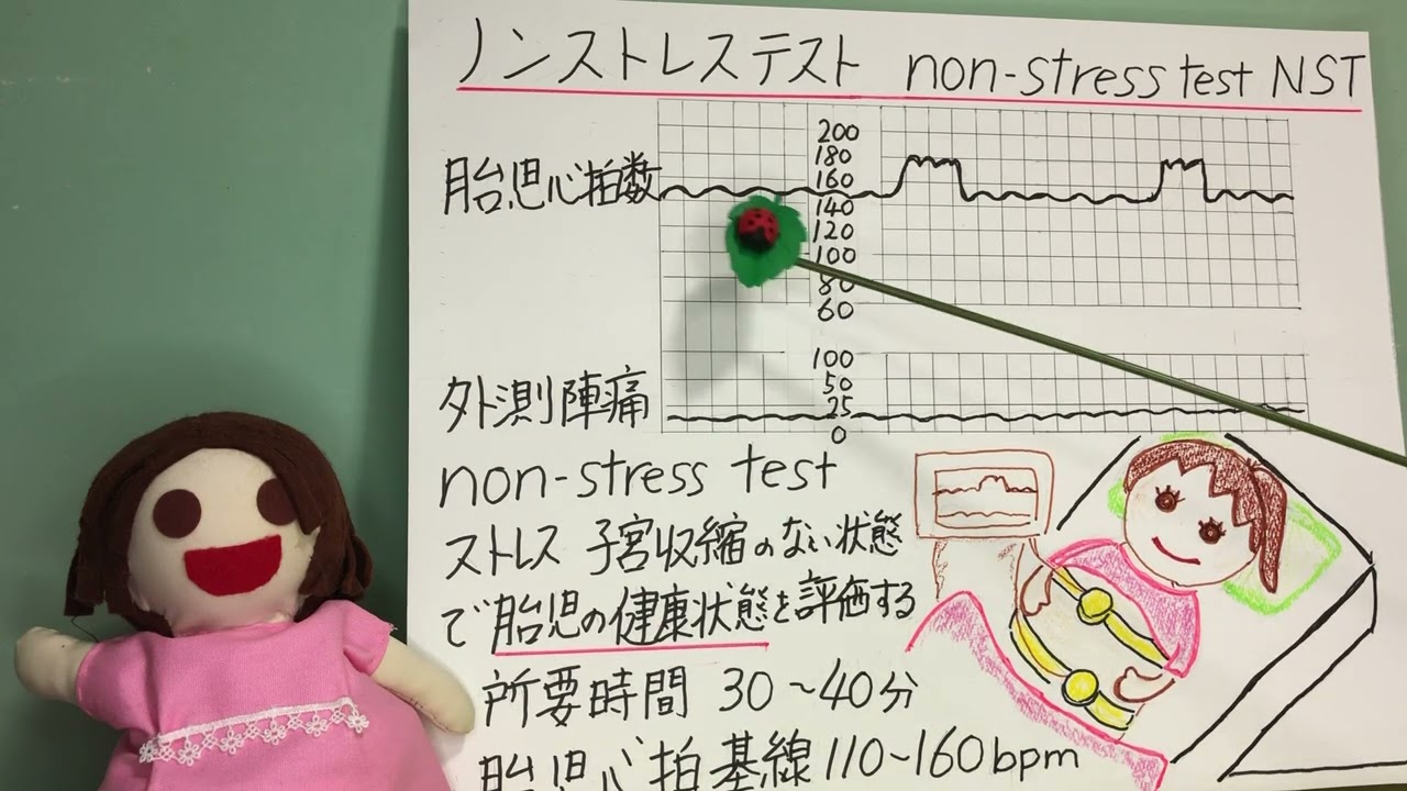 母性看護学 NST ノンストレステストって何を見るの？ - YouTube