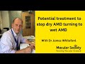 Potential treatment to stop dry AMD turning to wet AMD