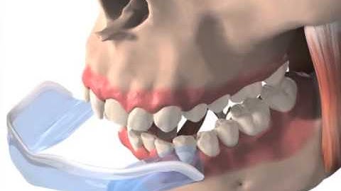 Aqualizer Film Teaser