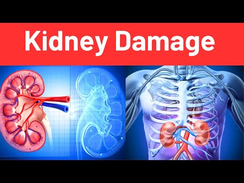 Chronic Kidney Disease