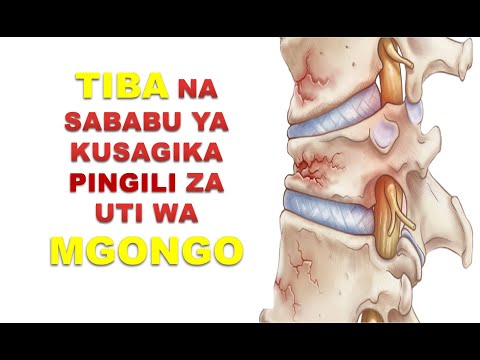 Video: Kupooza Kwa Sababu Ya Kuumia Kwa Kamba Ya Mgongo Katika Paka