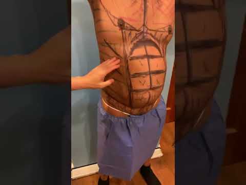 LEBO GYNO &