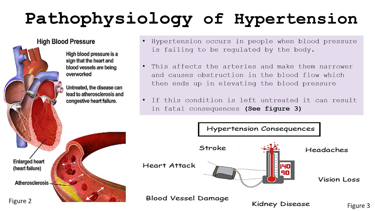 initial presentation of hypertension