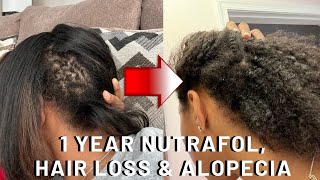 HOW I GREW MY SHORT DAMAGED HAIR | Hair Update + Nutrafol 1 year Review, CCCA Hair loss