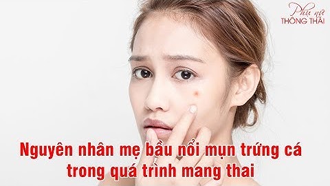 Có thai mặt nổi mụn nhiều la trai hay gái