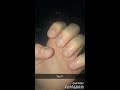 Nail growth journey 1// day 1 to 80 Mp3 Song