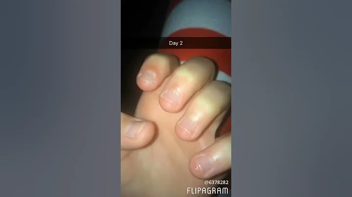 Nail growth journey 1// day 1 to 80 - DayDayNews