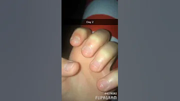 Nail growth journey 1// day 1 to 80