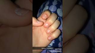 Nail growth journey 1// day 1 to 80 Resimi