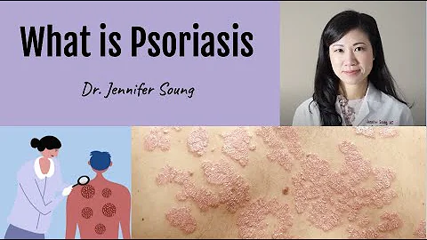 What is Psoriasis?