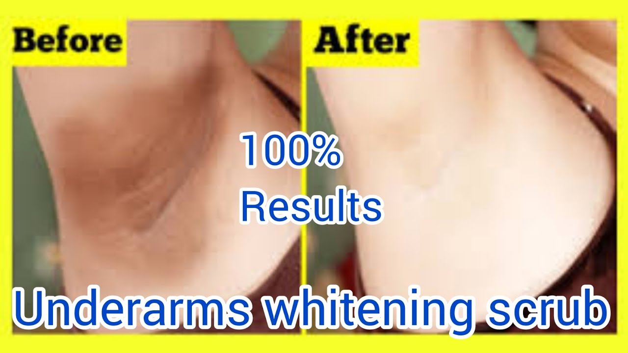 underarm whitening scrub underarm white kese kare YouTube