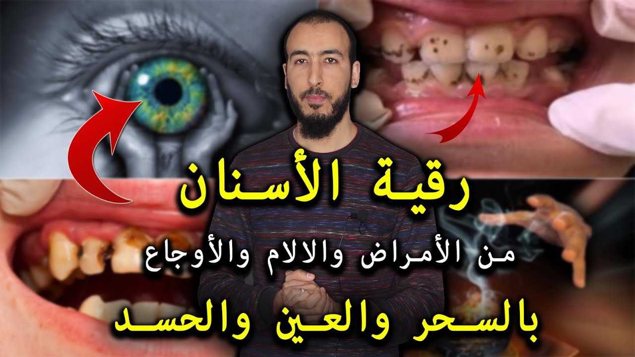 أقوى رقية لعقد الأسنان من السحر والعين والحسد المتسببة في الأمراض والآلام والأوجاع