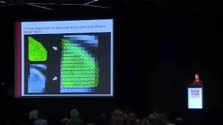 OHBM 2016 | Oral Session | Acquisition and Pre-processing Methods