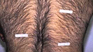 Assur Back Hair Extensions