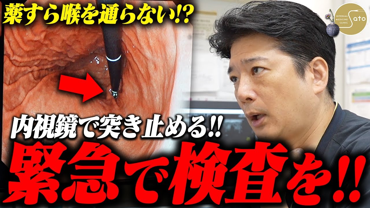『緊急胃カメラを！』薬すら喉を通らないと訴える患者... 医師が検査結果から導き出した原因とは！？