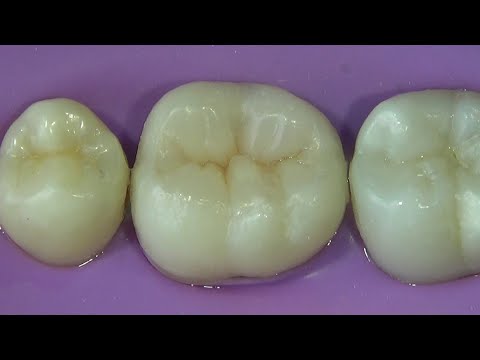 Easy - Dentística Descomplicada