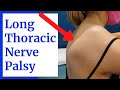 Long Thoracic Nerve Palsy (Shoulder Blade Winging) Evaluation