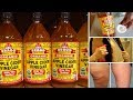 15 Surprising Uses For Apple Cider Vinegar You Never Knew About | Happy life