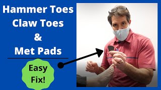 Hammer Toes, Claw Toes and Met Pads- Easy Fix!