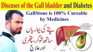 Gallbladder Problems |  Symptoms and Causes | Gallstone | Pain | Homeopathy Treatment | Hindi | Urdu