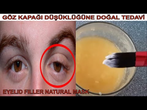 1005131 10201196277059278 1173312361 N 1 Jpg 479 459 Dusuk Gozler Gozler Skin Care