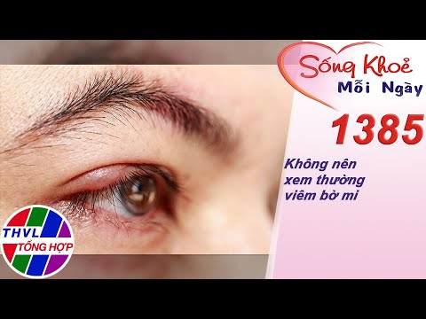 Video: 3 cách điều trị viêm bờ mi