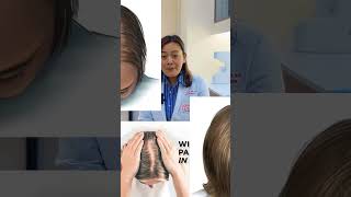 Early Signs of Female Hair Loss You Shouldn’t Ignore