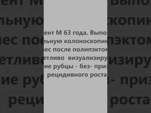 Результат полного выздоровления после удаления полипа в слепой кишке. Гладкий рубец.