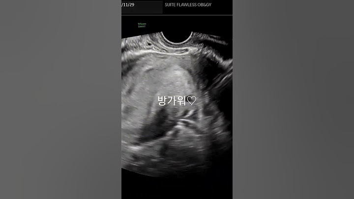 불혹 첫임신~!!(4주차)