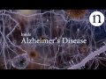 Inside alzheimers disease