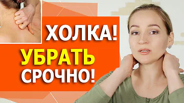 Чем опасна холка? Полный комплекс как убрать холку. Вдовий горб.