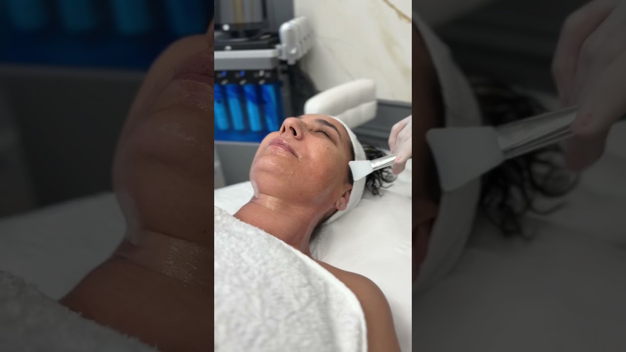 A spus cineva lifting facial? 