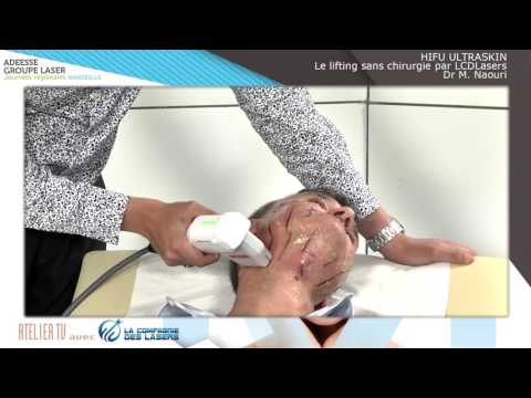 HIFU ULTRASKIN : Le lifting sans chirurgie par LCDLasers.com