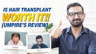 Why Umpire Anil Chaudhary Chose La Densitae? | Best Hair Transplant Clinic in Mumbai