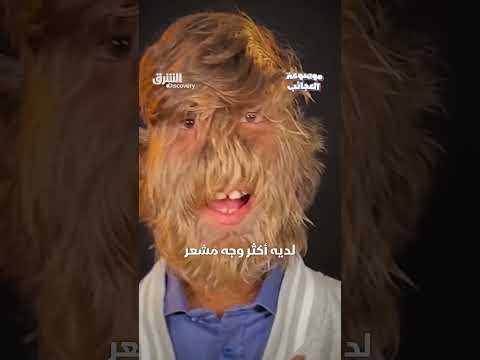 الهندي لاله باتيدار يحطم رقماً قياسياً في موسوعة جينس