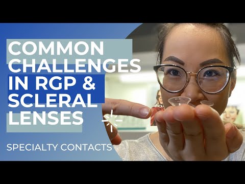 Specialty Contact Lenses Common Challenges