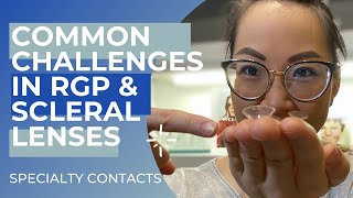 Specialty Contact Lenses: Common Challenges