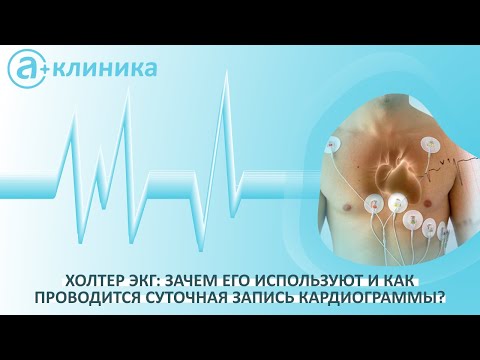 Холтер ЭКГ: зачем его используют и как проводится суточная запись кардиограммы?