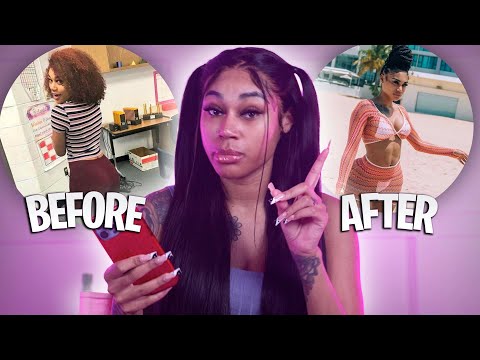 Revealing My Before and After Surgery Pictures! 😱