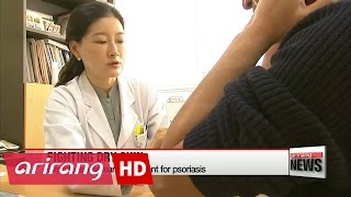 Experts advise early treatment for psoriasis