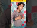 Bhai Bana Kala Naag 😂😜 Part- 106 😲😂लोगों के गजब कारनामे😂😲 #shorts #bakwaslifehacks  #funny #comedy