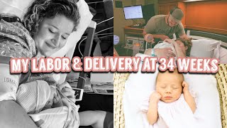 MY BIRTH STORY | 34 WEEK DELIVERY