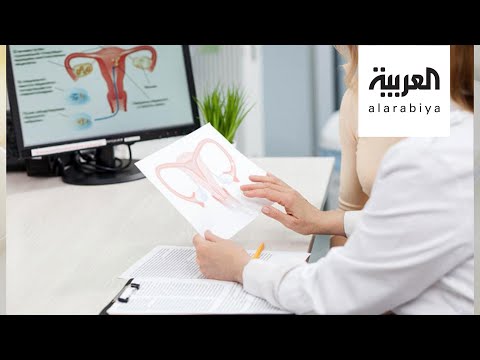 صباح العربية | ما أعراض مرض بطانة الرحم المهاجرة؟